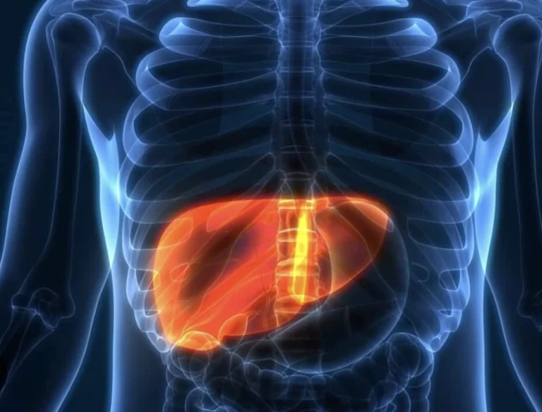 Fatty Liver Disease